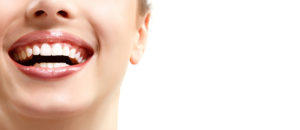 Diseño de sonrisas - carillas dentales - Corus SKYN Lab